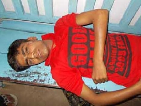 Teen scorching explosion in garbage dumps.