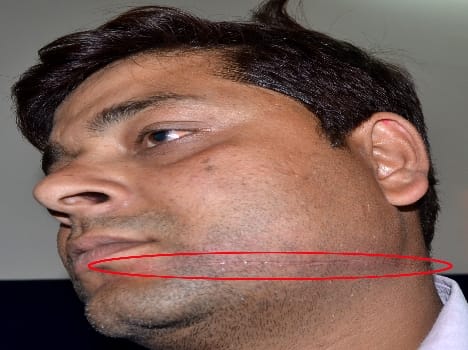 Chinese entangled bike rider injured in Manje