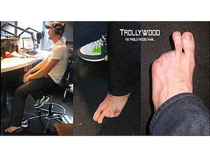 why martin gutpil called two toes 