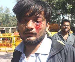 DU North Campus Violence