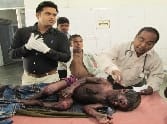 House fire Woman , child scorched
