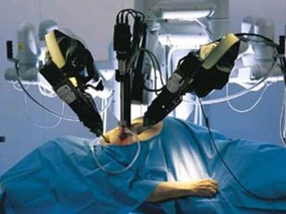 good news, robotic surgery in PGI cheaper
