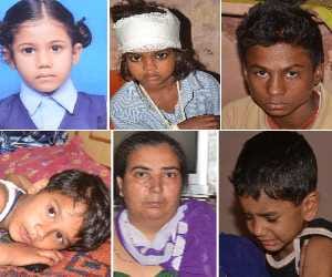 16 including 11 children became hunting of dreaded stray dog 