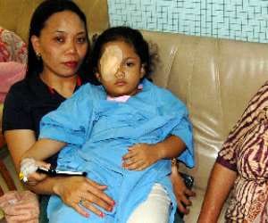 jumble in left eye, right eye operation