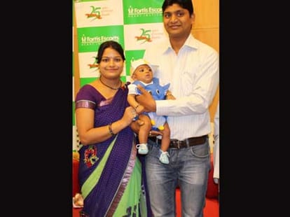 Successful open heart surgery of infant in delhi