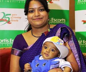 Successful open heart surgery of infant in delhi