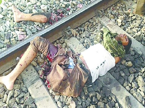 Tight young man jumped in front of the train from the disease, leg cut
