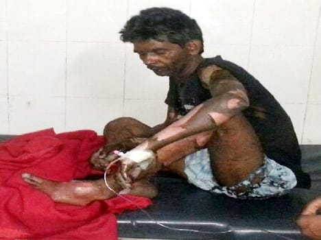 Set fire due to civil strife woman