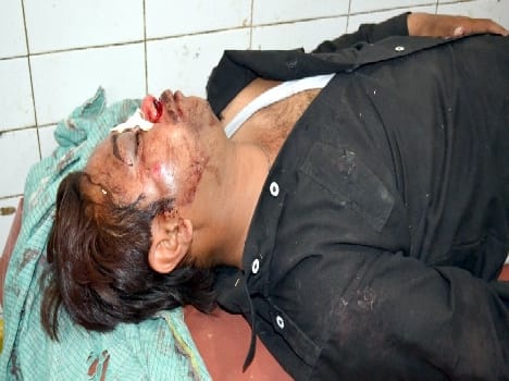 Four in a road accident Injured , two critically