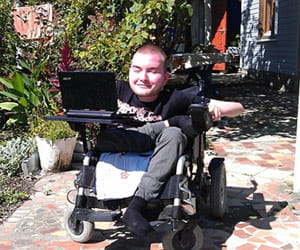 world's first head transplant to happen soon