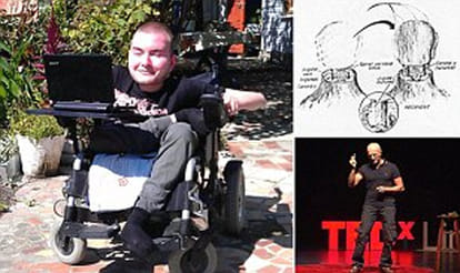 world's first head transplant to happen soon
