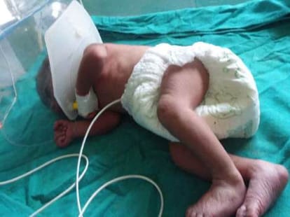 bihar ips shivdeep lande save newborn girls life