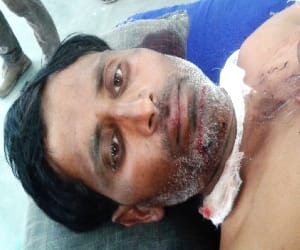 Wild pig attack Three farmers injured