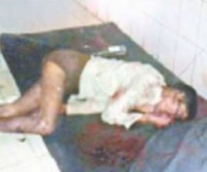 doctors carelessness case in baharaich
