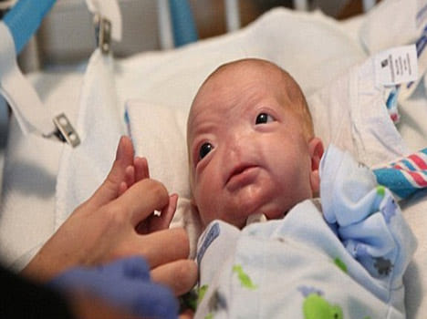 alabama boy without a nose