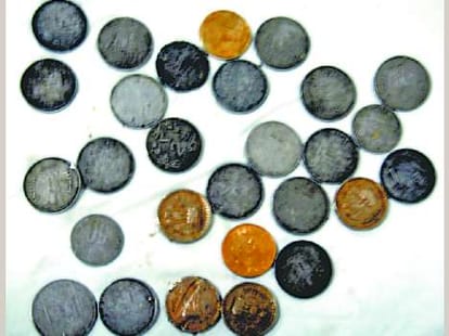 omg news, man eat coin last three year