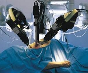 Robotic surgery started in sgpgi hospital