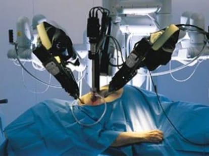 Robotic surgery started in sgpgi hospital