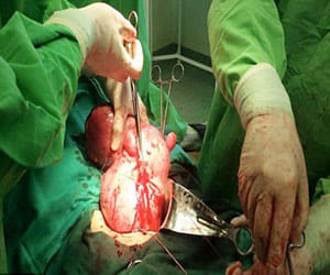 7 kilo tumor found in Uterus.