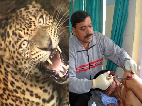 leopard attack on seven people.