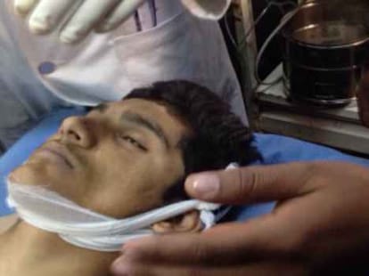 here is the postmortem report of youth dies in trap case
