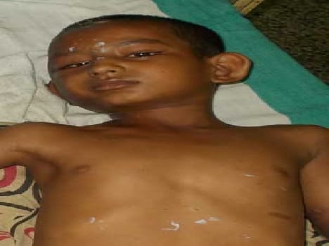 Litter blast killed two children , two injured