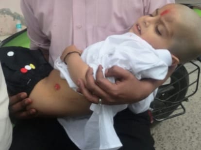 boy crushed under car near una.