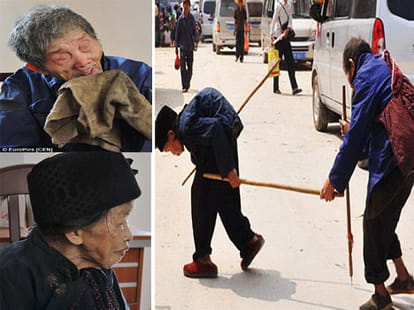 hunchback wife guides way to blind husband for over 55 years
