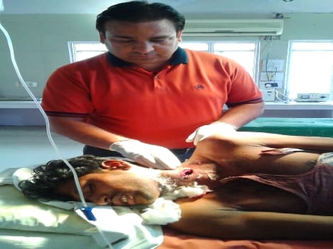 Young man wounded by the fire while loading cartridge