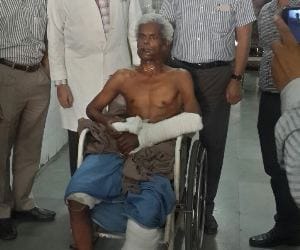 Kgmu doctors do double free flap surgery