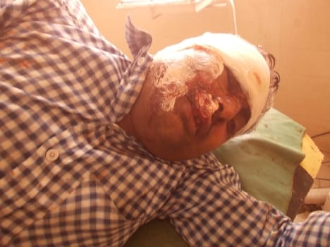 Four young men wounded in separate incidents