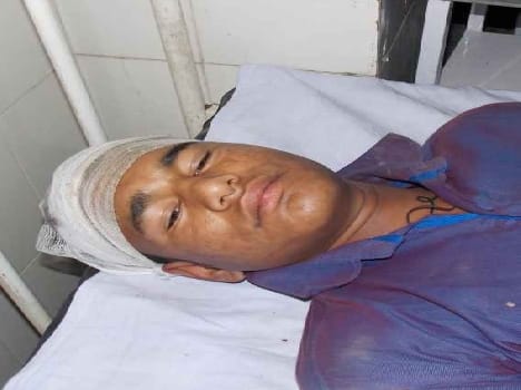 Bolero falls into ditch, driver injured including six Barati