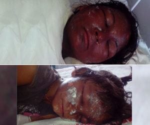 acid attack on wife and daughter, serious injured