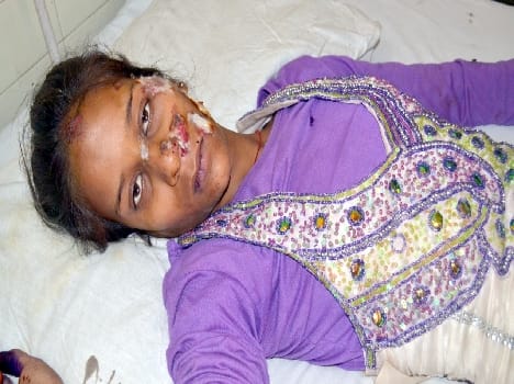 Two separate accidents killed , five injured