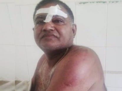 on duty ASI beaten by drug smugglers at station