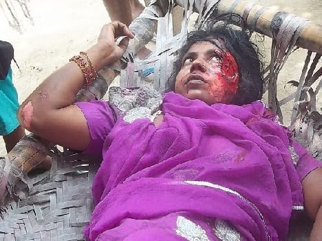 A death in a road accident, a wounded