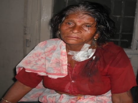 Tiger did the old woman wounded