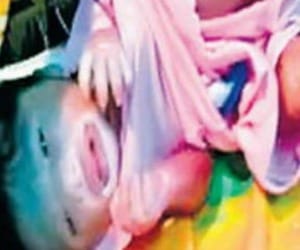 plastic skin girl born at amritsar