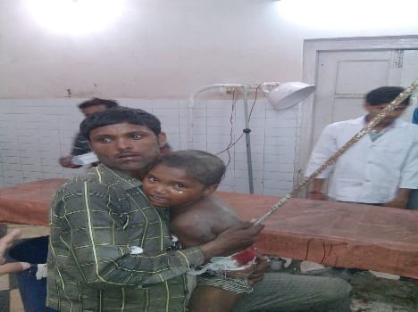 Balcony collapse rod rammed into the back of the child