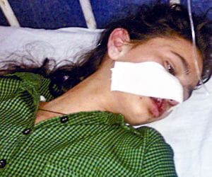 girl attacked in auto badly injured