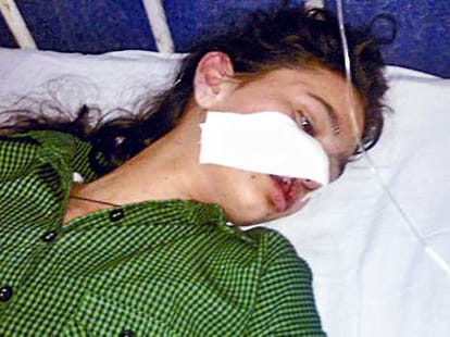 girl attacked in auto badly injured
