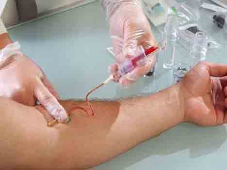 know diagnostic tests to determine which is going to free government