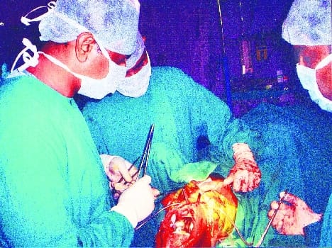 Women 40 thousand, but there is no female doctor
