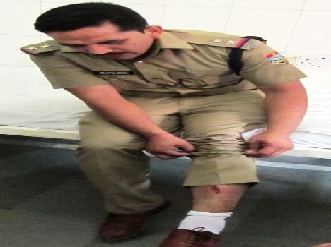 The police team attacked catch history-sheeter