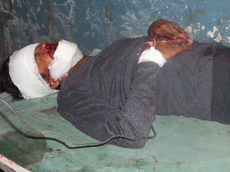 Four injured in clash of two bikes