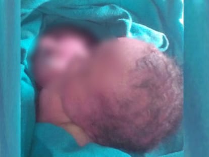 deadly delivery: a child born in auto and another in jeep