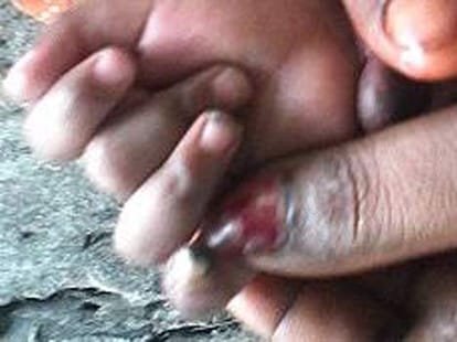 people are burning  children's fingers.