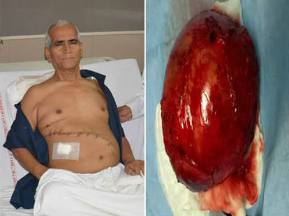 punjab kidney racket, sensational truth