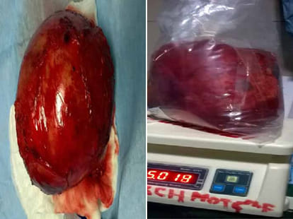 Hospital workers seen removing, selling organs from bodies in a sting