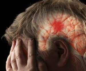 strokes rising in young people
